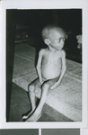 A Child Suffering from Malnutrition, Nigeria, ca.1967-1969